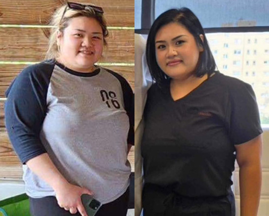 Weight Loss Before and After Photo by Forward Healthy Lifestyles in Germantown, WI