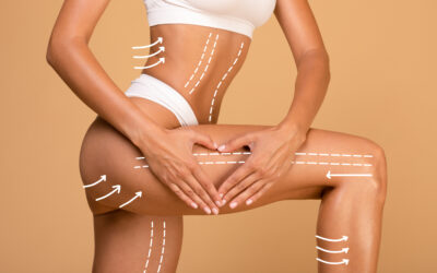 Sculpt and Define: The Benefits of Body Contouring with BTL Exilis Ultra